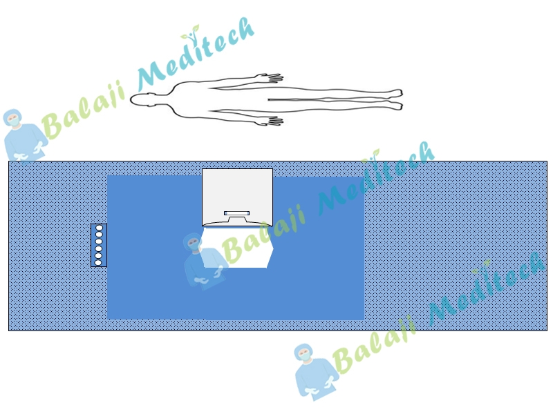 Laparoscopy Drape